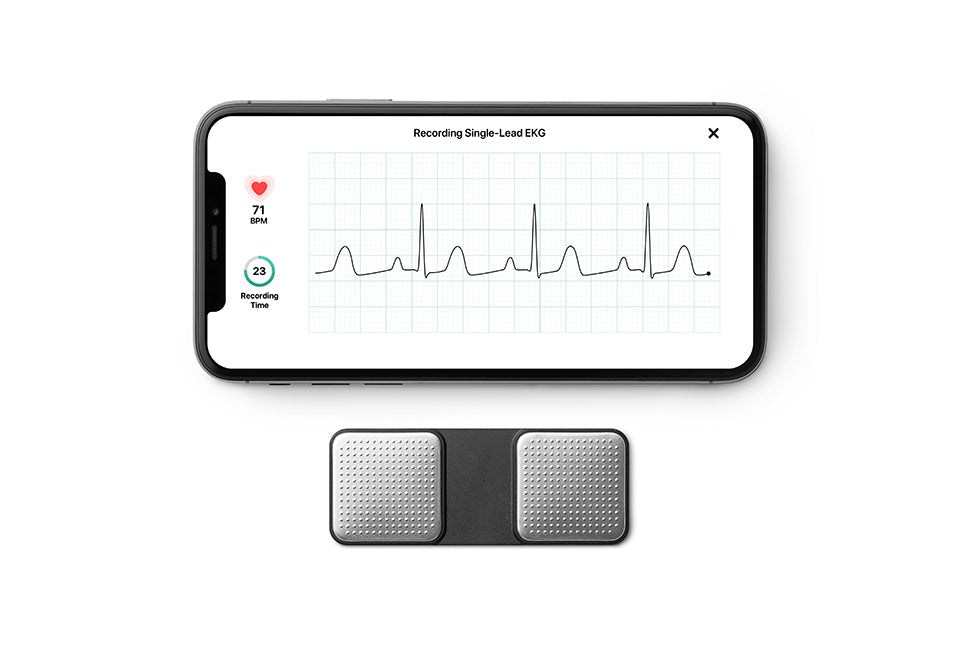 Portable EKG