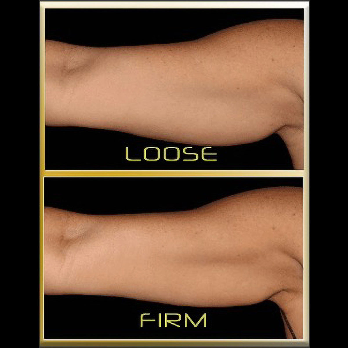 Underarm Toner