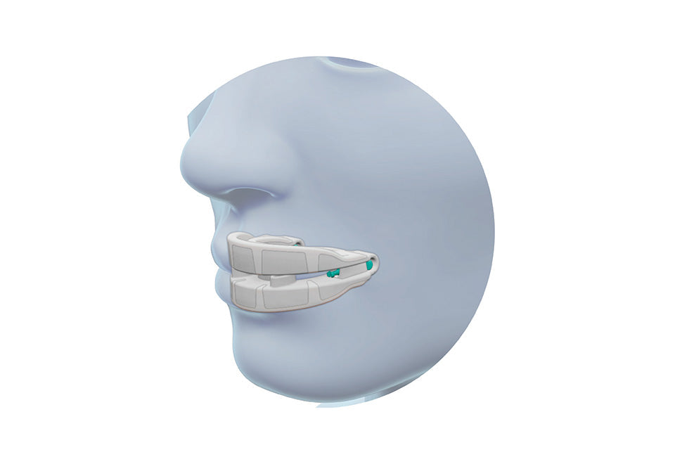Anti Snoring Mouthpiece Device