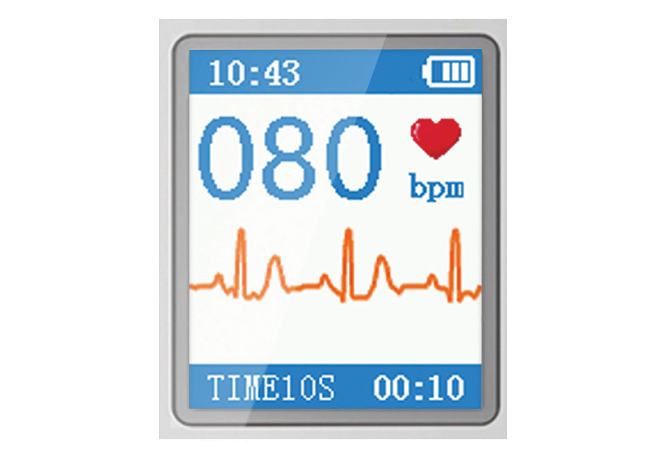 Portable Smart Bluetooth EKG Monitor