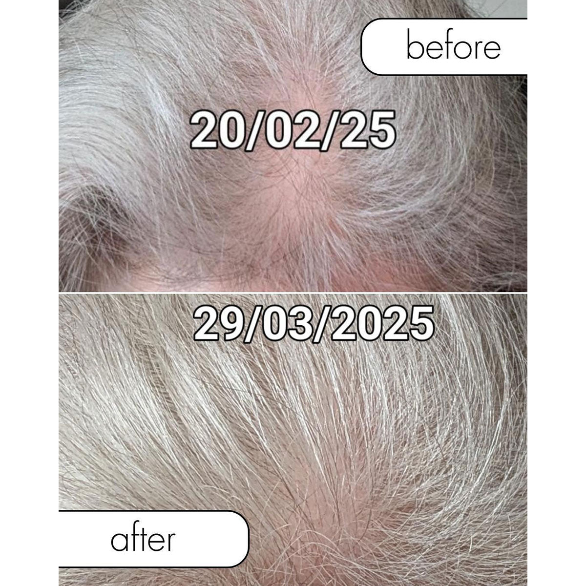 Wireless Hair Growth Brush
