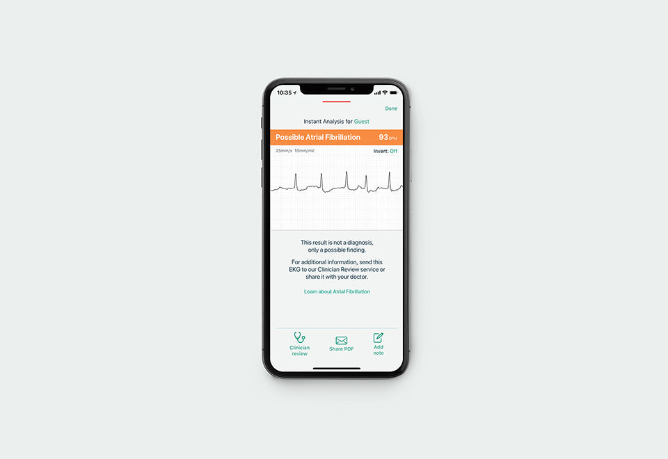 Portable EKG