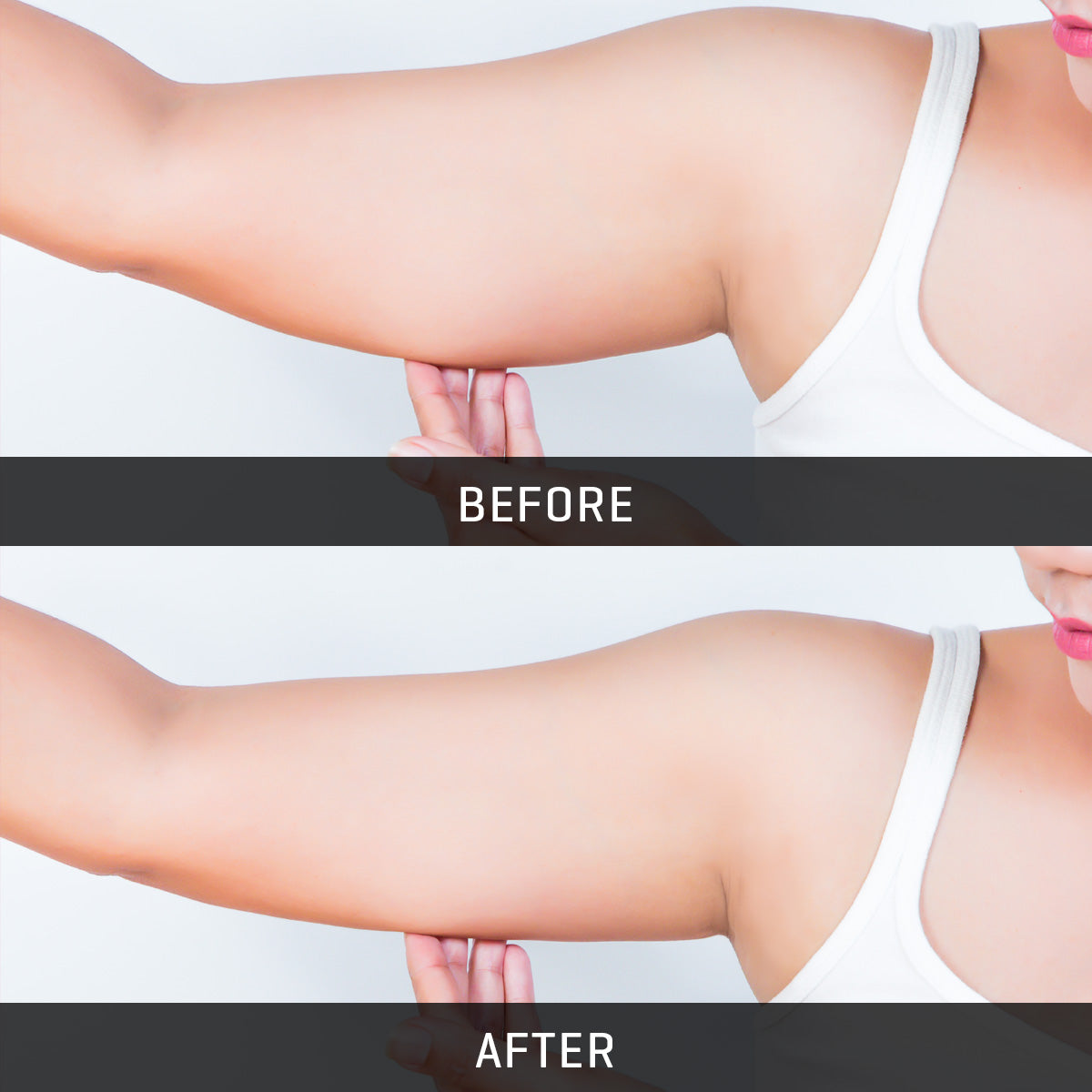 Underarm Toner
