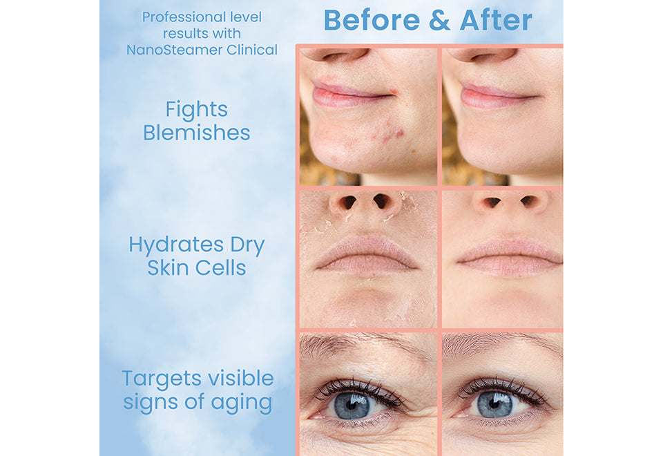 Professional Grade Facial Steamer