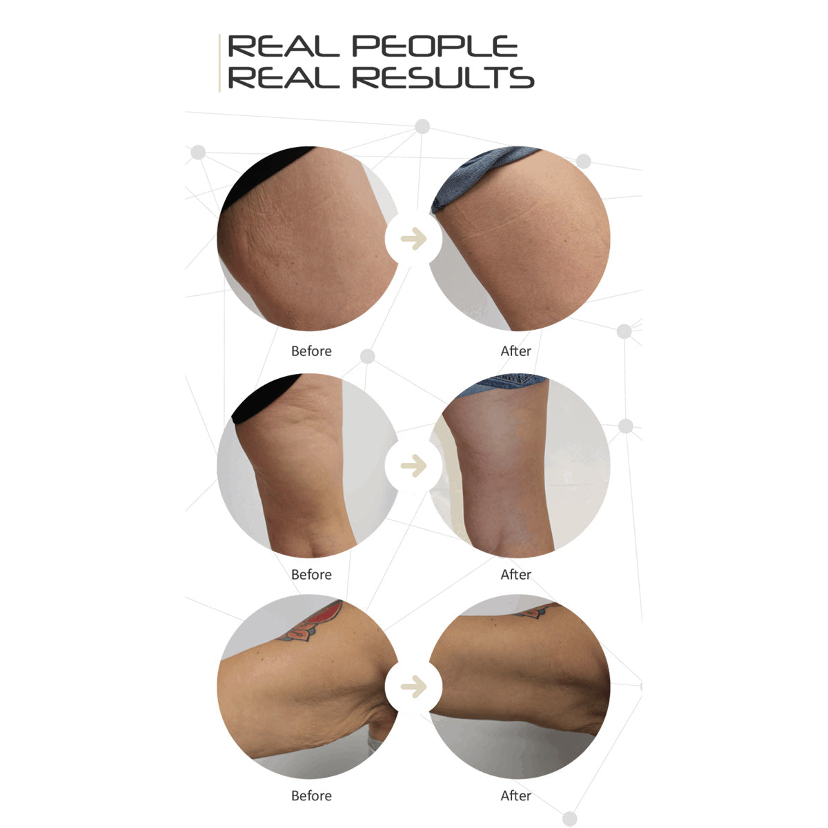 LED Cellulite Reducing Device