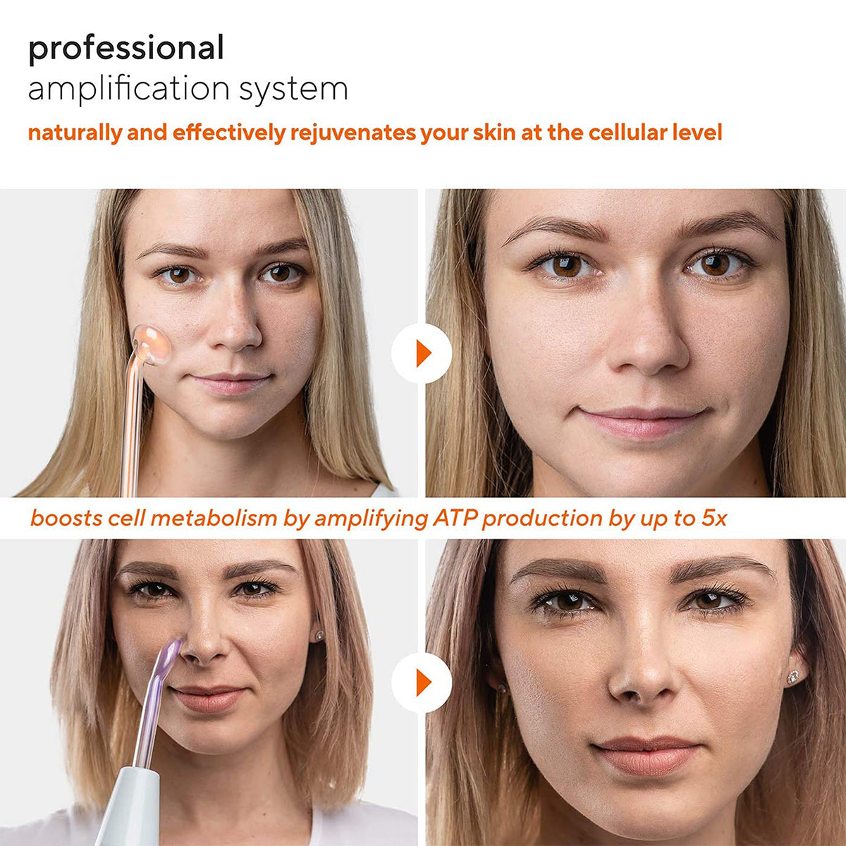 Professional Skin Rejuvenator