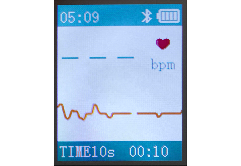 Portable Smart Bluetooth EKG Monitor