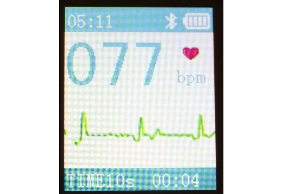 Portable Smart Bluetooth EKG Monitor