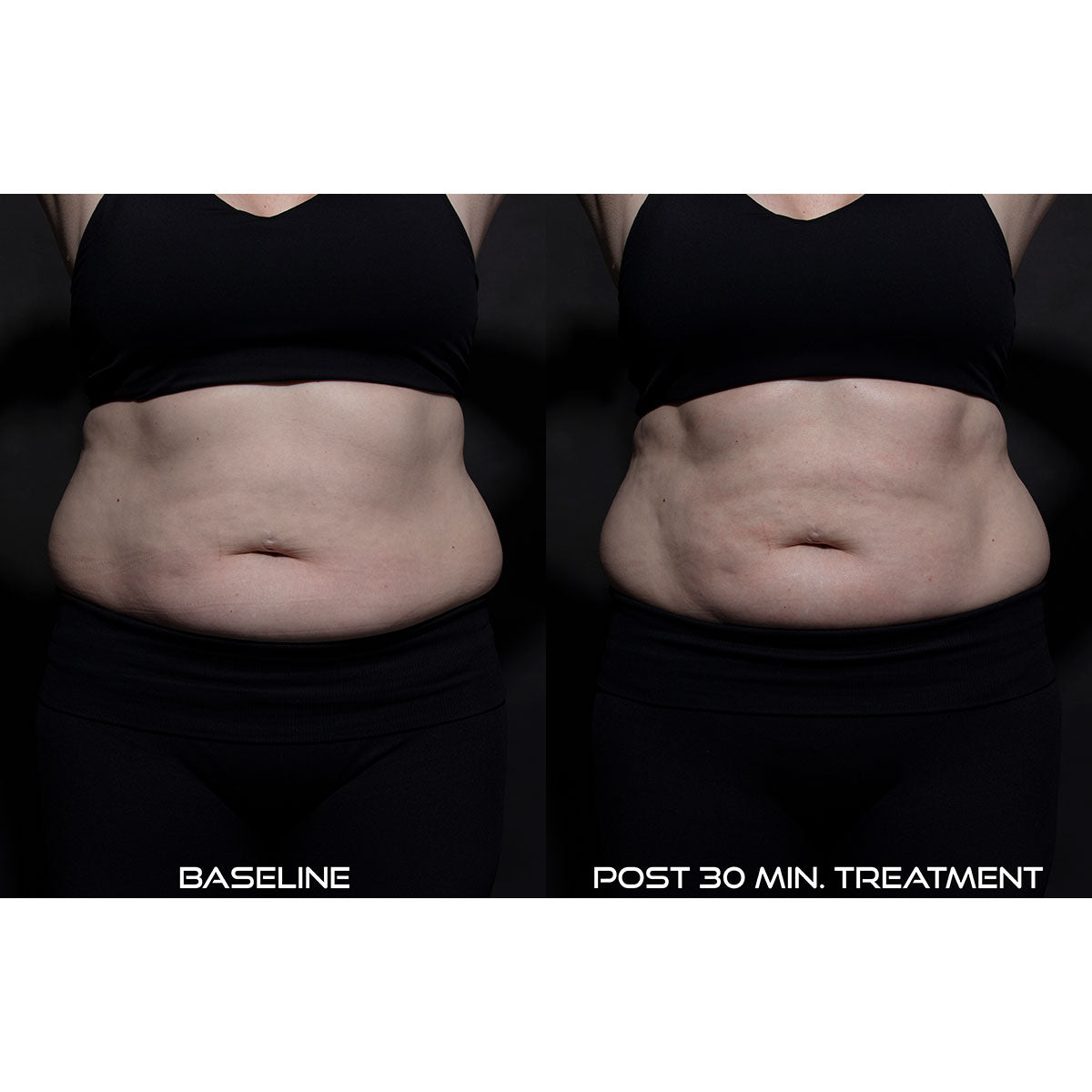 5-in-1 Body Contouring Device